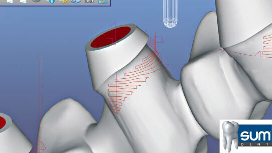 CAD/CAM dalla parte del cliente