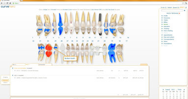 Curve Dental’s newest upgrade emphasizes efficiencies in insurance deductibles