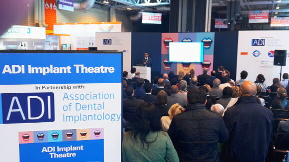 Glasgow congress of ADI to focus on all things implant