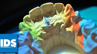 Prothetik & Implantologie auf der IDS 2015 Prothetik & Implantologie auf der IDS 2015