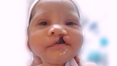 7 Luna con placa en boca