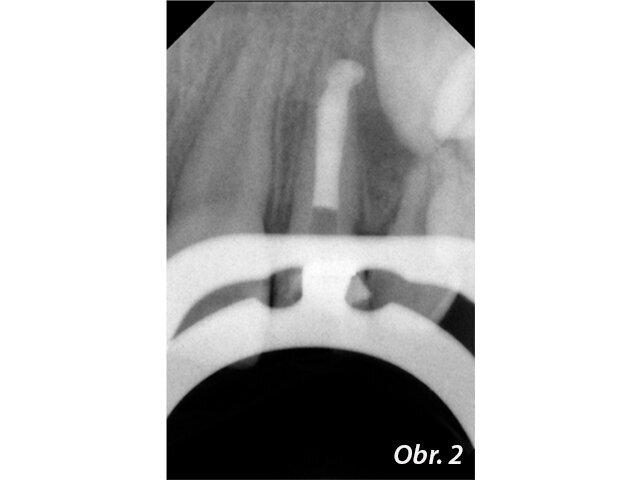 Obr. 2: červen 2008