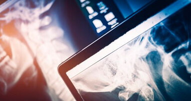 Rischi da Raggi-X: monito delle autorità tedesche agli espositori asiatici di IDS