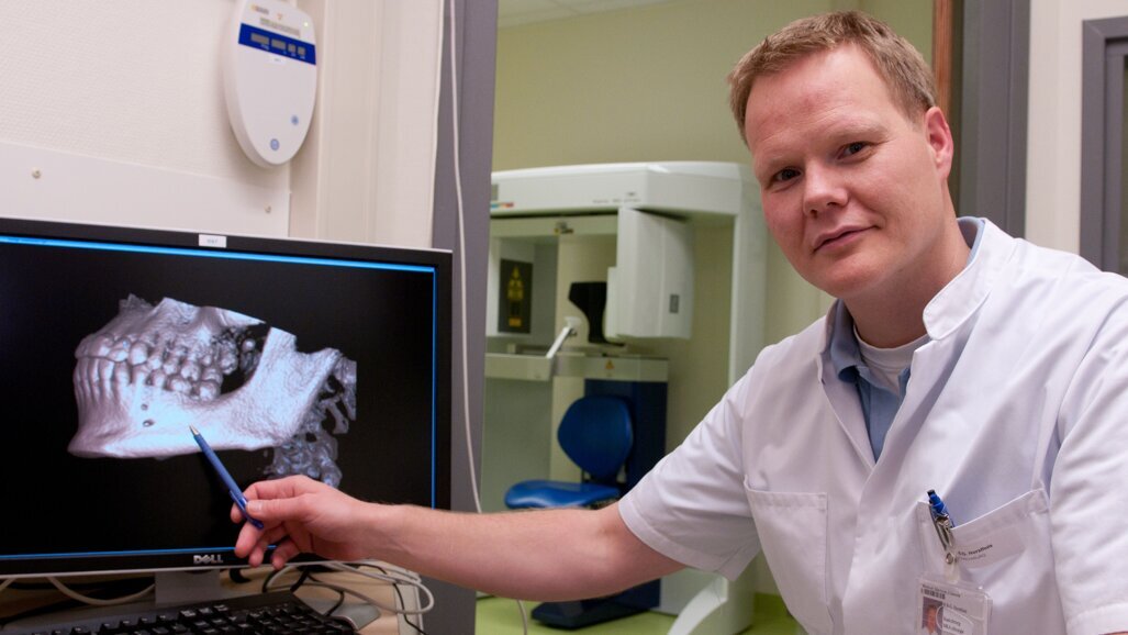 Onderzoek naar mogelijke risico’s CT-scans