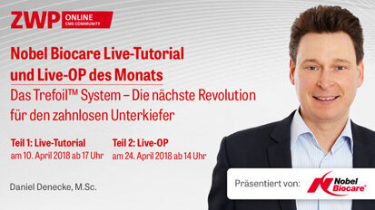Nobel Biocare Live-Praxis-Tutorial & Live-OP: Das Trefoil System Nobel Biocare Live-Praxis-Tutorial & Live-OP: Das Trefoil System