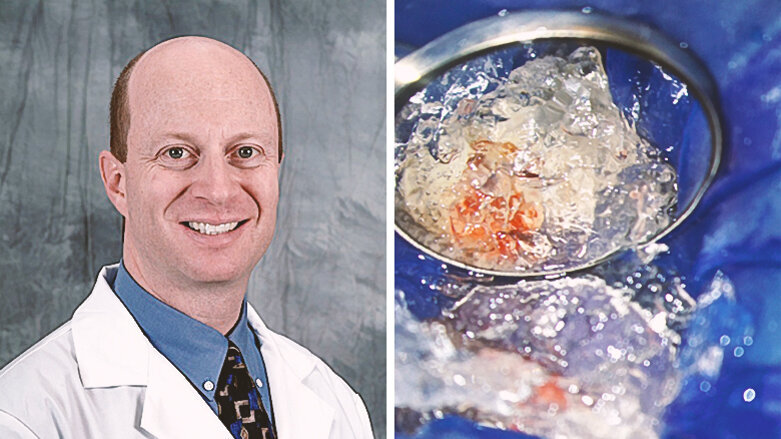 Interview: “Bioactive endodontics is the future”