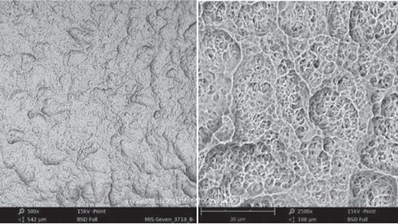 Implantes MIS destacam-se em estudo comparativo de implante de superfície