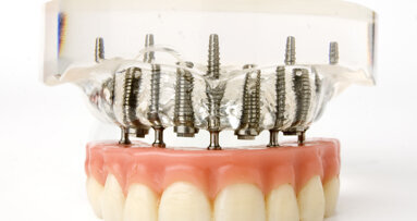 Implanteren in bovenkaak tegen kaakbotslijtage