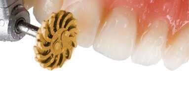 Enhance Flex: la nuova frontiera della finitura e lucidatura dei restauri in composito