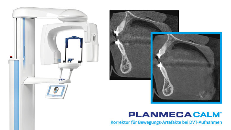 Hervorragende Bildgebung mit DVT-Geräten von Planmeca