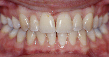 Harmonization of the dento-facial complex