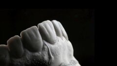 Redefining smile harmony: The concept of Hood Proportion for the  Malaysian population