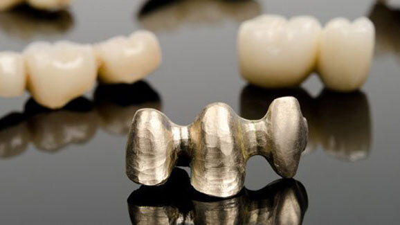 Aktuelle Trends bei Legierungen auf der IDS 2013