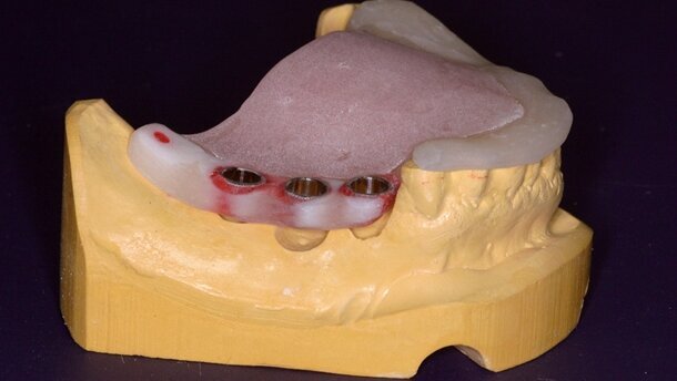 Image guided surgery