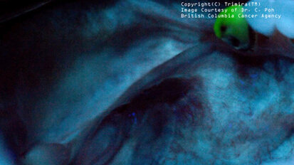 Trimira offers oral cancer images online