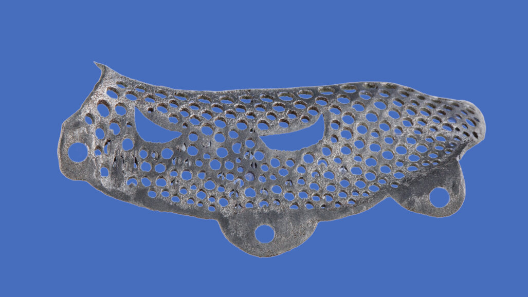 3D printing has an expanding role in implantology