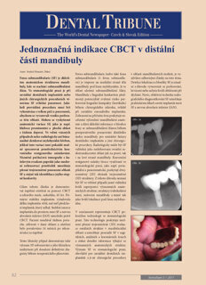 DT Czech and Slovak Republic No. 3, 2017