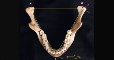 Kinesiographic analysis of lateral excursive movement on the horizontal plane: the retrusive component