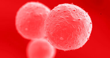 Matične ćelije iz koštane srži presađene u vilicu pacijenta