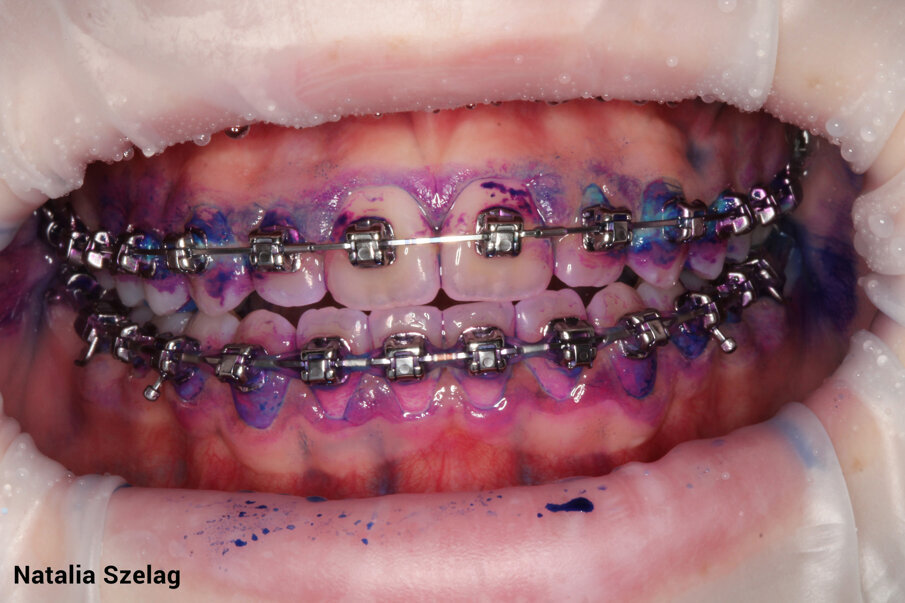 Fig. 3b: After disclosing