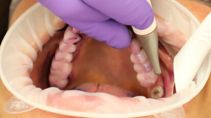 La contaminazione batterica dell’aria nella sala operativa durante un trattamento AIRFLOW