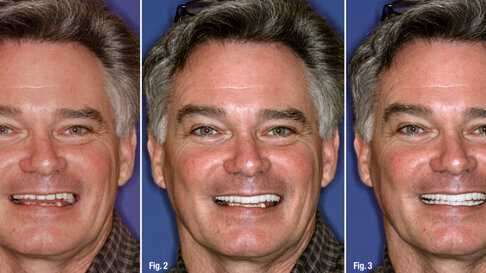 New smile, new life—innovative technologies and techniques can transform a smile