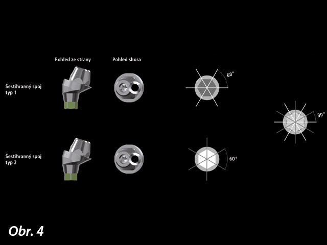 MUA lze použít pro indikace vyžadující různou míru rozbíhavosti. Lze je totiž zakoupit s různými spoji (šestihrannými, čtvercovými, trojúhelníkovými a osmihrannými): každý spoj je k dispozici ve dvou různých typologiích.