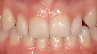 Bioestetica:  un nuovo approccio al miglioramento del sorriso