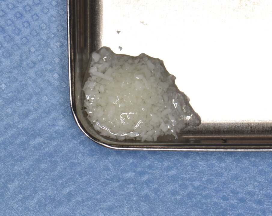 Fig. 12 - Biomateriale di origine eterologa.