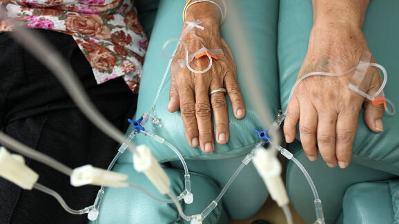 Les patients atteints d’un cancer de la bouche HPV-positif ont de meilleures chances de survie