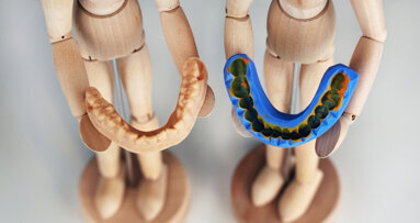 Digital impression taking in modern dentistry