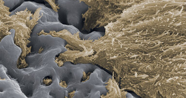 TiUnite: un biomateriale esclusivo