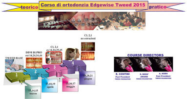 L’ortodonzia Edgewise Tweed oggi
