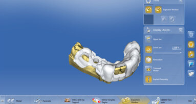 Proteticky řízené umístění implantátu a náhrady: Rychlý a elegantní pracovní postup Dentsply Sirona