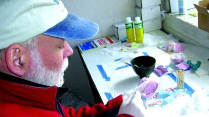 Nepal-Zähne könnten Rätsel um Entstehung von Lippen-Kiefer-Gaumenspalte lösen