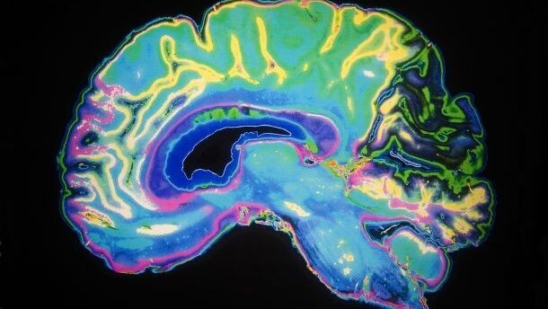 Elektrostymulacja mózgu sposobem na strach przed dentystą?