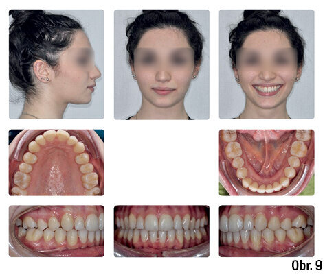 Kazuistika - popis v textu