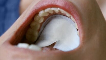 DryDent, control óptimo Dde la humedad