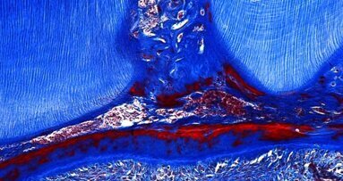 Regénération des dents grâce à une médicament contre Alzheimer