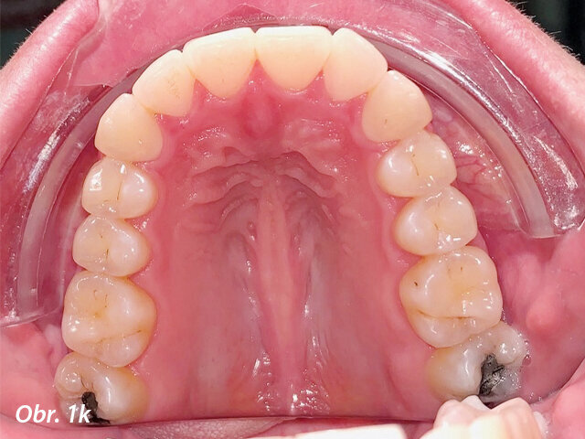Pacientka 1 – Počáteční fotografie.