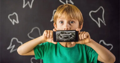 Nova AI platforma omogućuje revolucionarno rano otkrivanje karijesa u dječjoj dobi