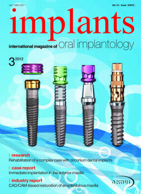 implants international No. 3, 2012 implants international No. 3, 2012