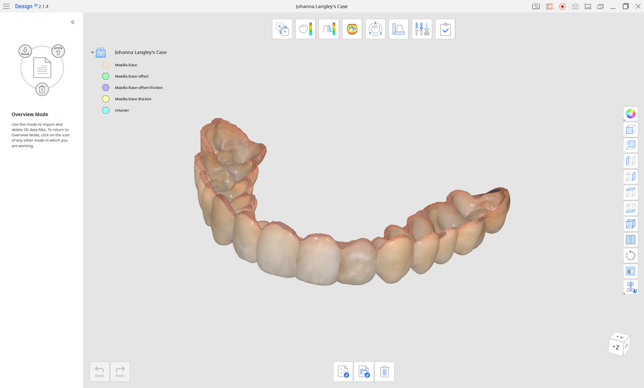 Fig. 4a: Provisional retainer design in Medit Design.
