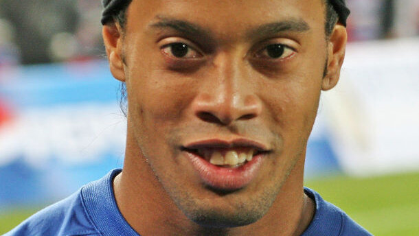 Ronaldinho faz cirurgia estética oral