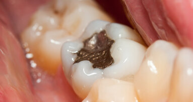 Nederlandse ‘horrortandarts’ ruïneerde Franse gebitten