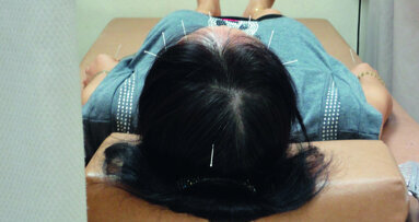 Acupuncture : Elle sonde le terrain en dentisterie – Partie I