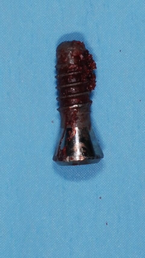 Fig. 6 - Impianto rimosso.