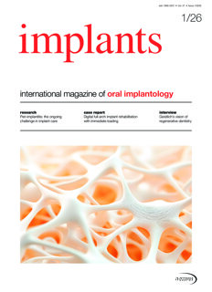 implants-international-no-1-2026