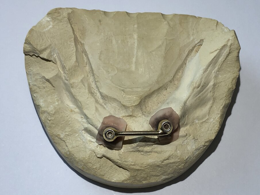 Afbeelding 2. Reguliere staafconstructie.   