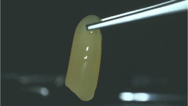 In Odontoiatria sono legali i fattori di crescita piastrinici autologhi?